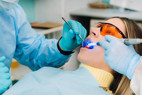Resin Application Dental Fillings Dentistry Of Orlando | Dentistry Of Orlando Dental Filling | Dentistry Of Orlando