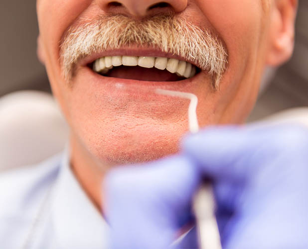 Dental Crowns | Dentistry Of Orlando