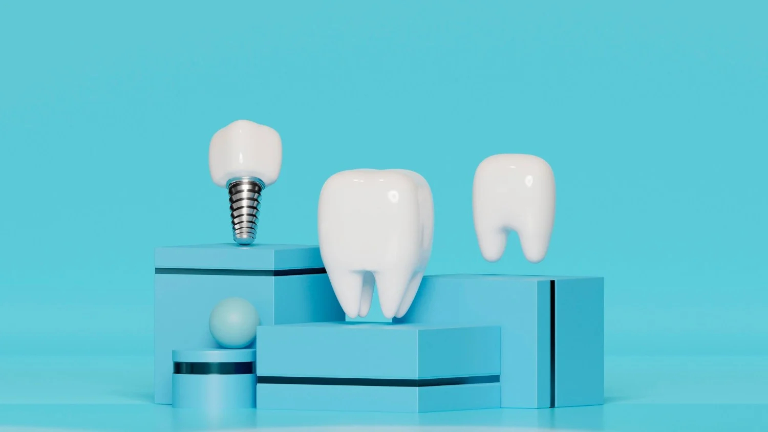 Dental Implants - Dentistry of Orlando