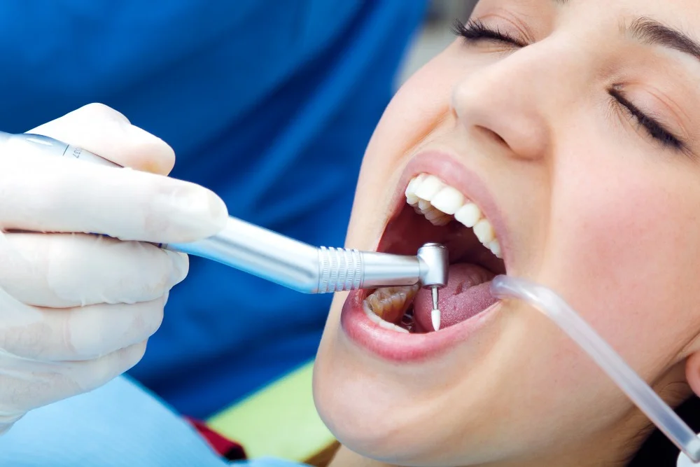 Dental Cleaning - Dentistry of Orlando
