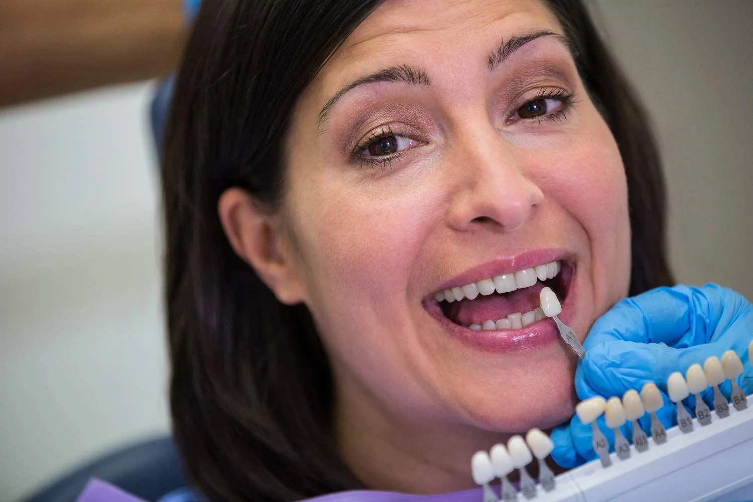 Dental Implants Front Teeth - Dentistry of Orlando