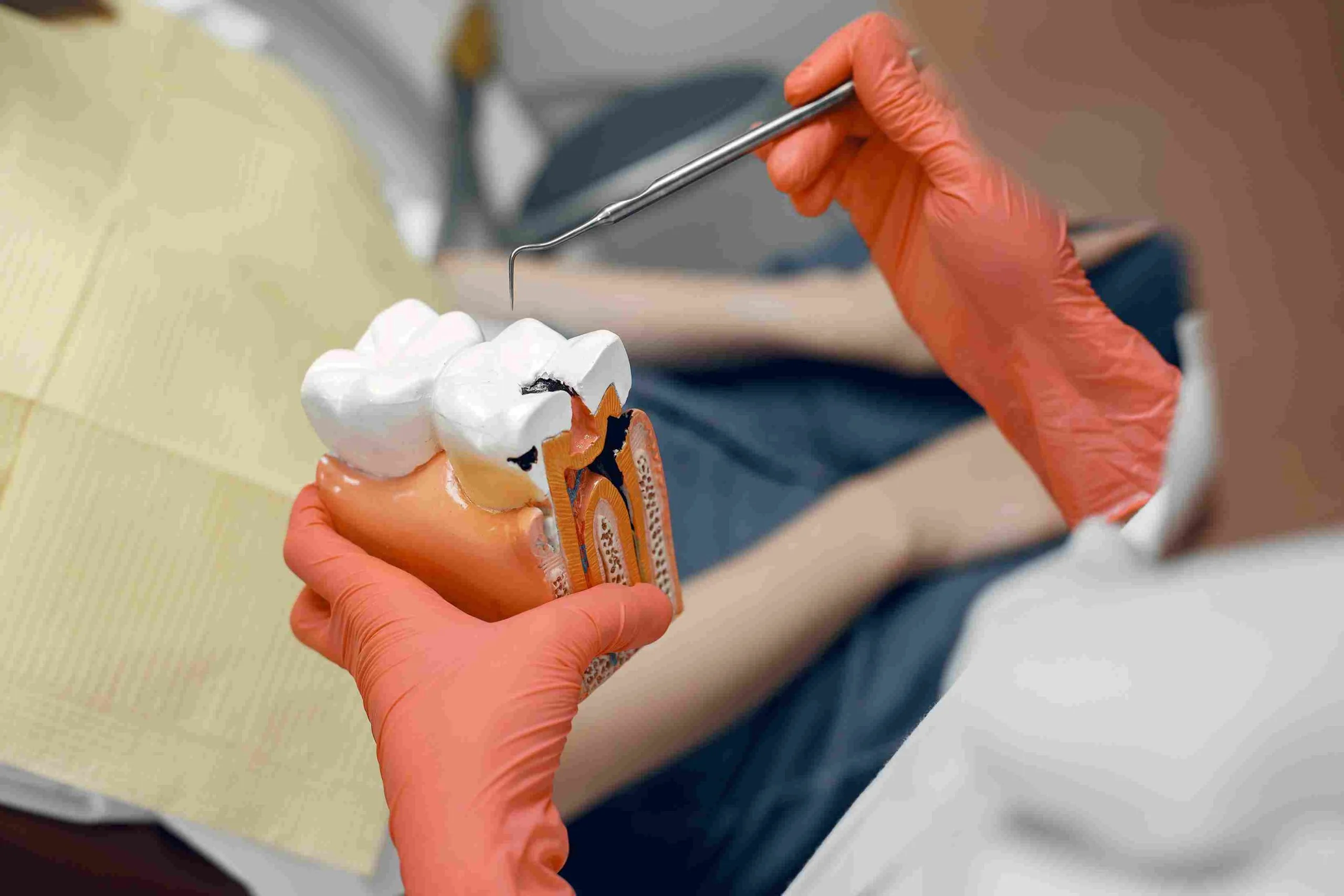 Root Canal Procedures - Dentistry of Orlando